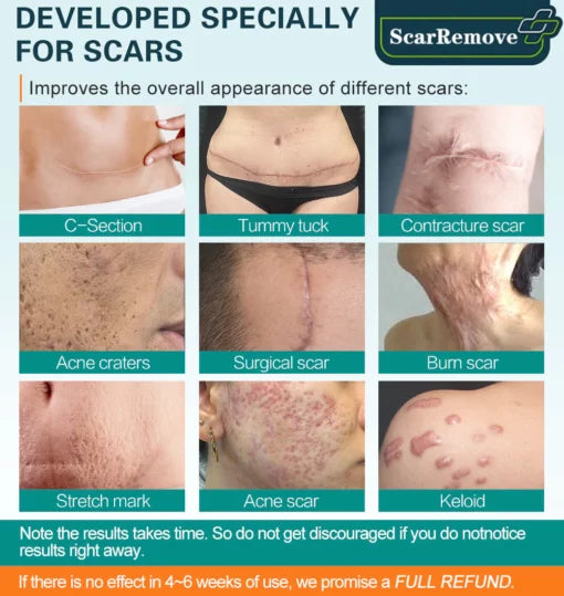 Fivfivgo™ Advanced Anti-Scar spray